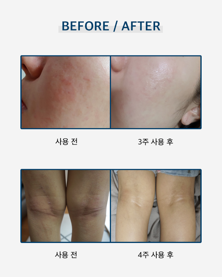 아이뷰티 이미지