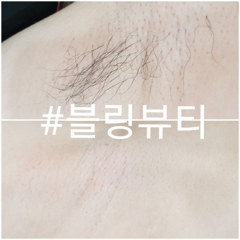 뷰티블링 이미지