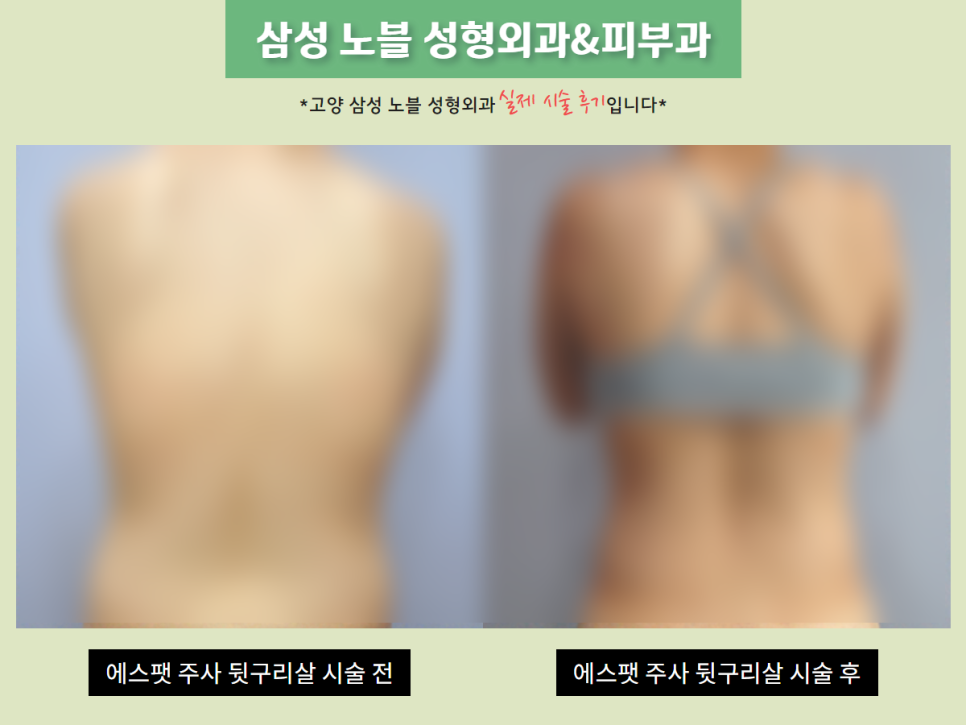 은삼성성형외과 이미지