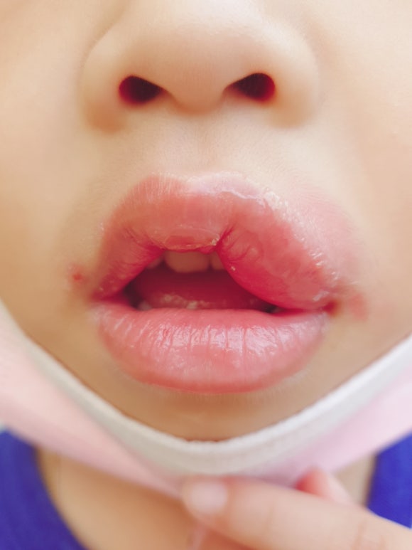임기현소아청소년과 이미지