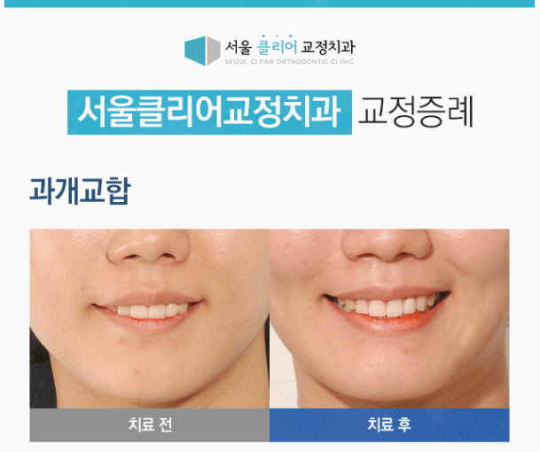 서울클리어치과교정과치과의원 이미지