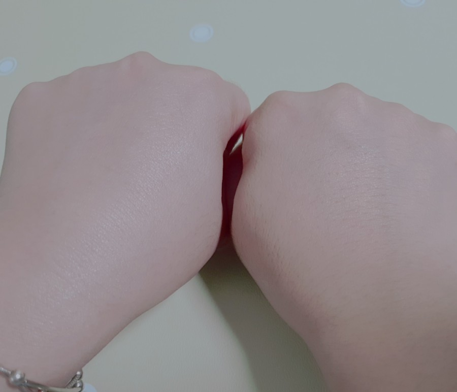 휘테라피 이미지
