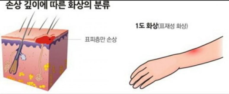 뷰티블링 이미지