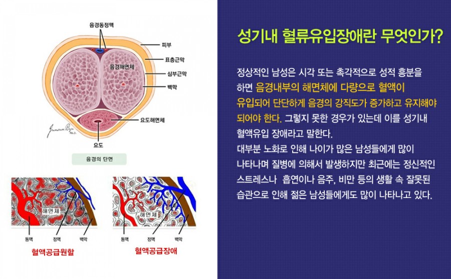 조이텍 이미지