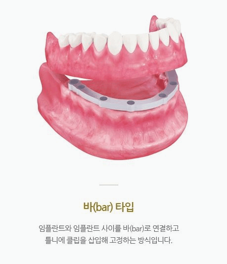 서울더좋은치과의원 이미지