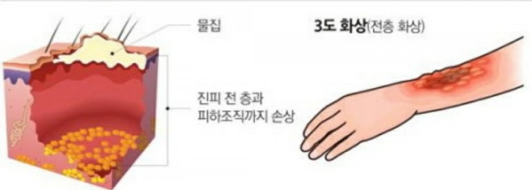 뷰티블링 이미지