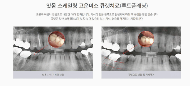 연세고운미소치과의원 이미지