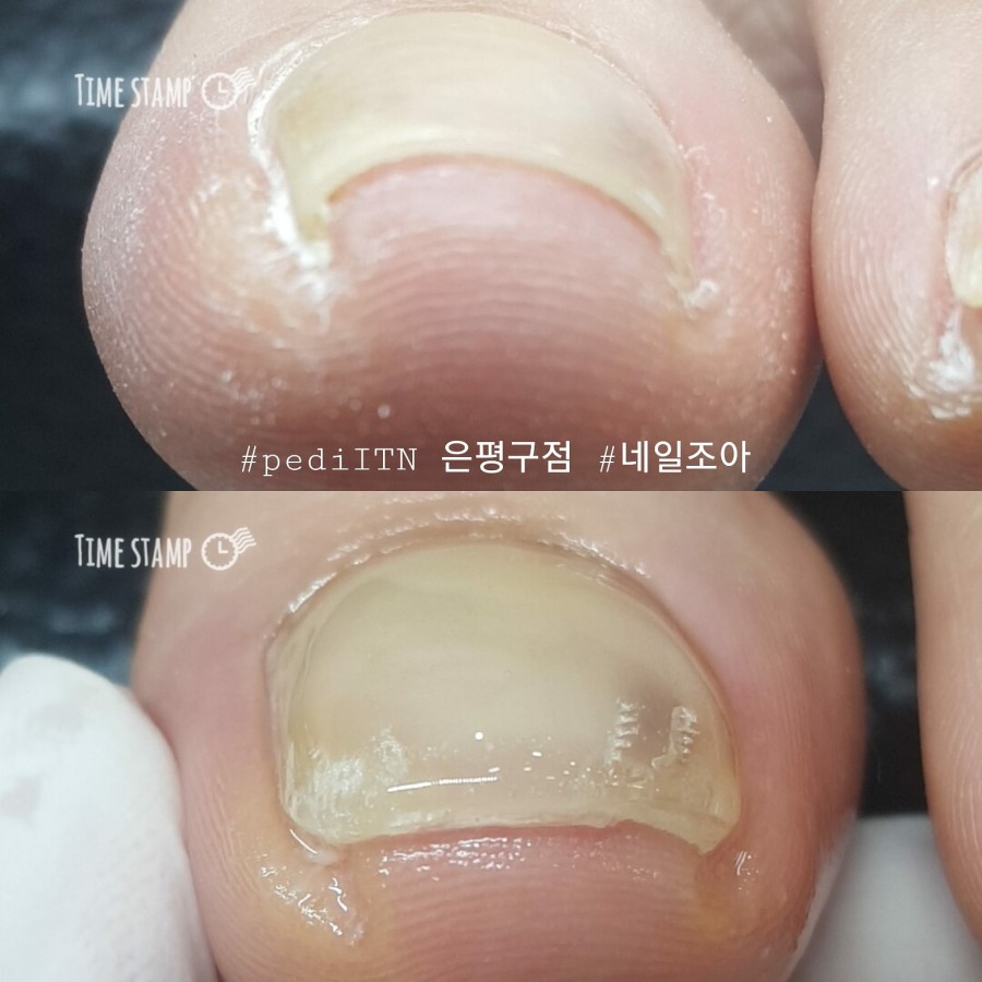 네일조아 이미지