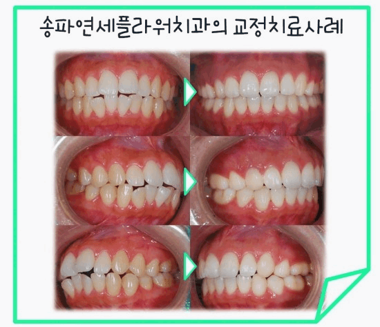 송파연세치과의원 이미지
