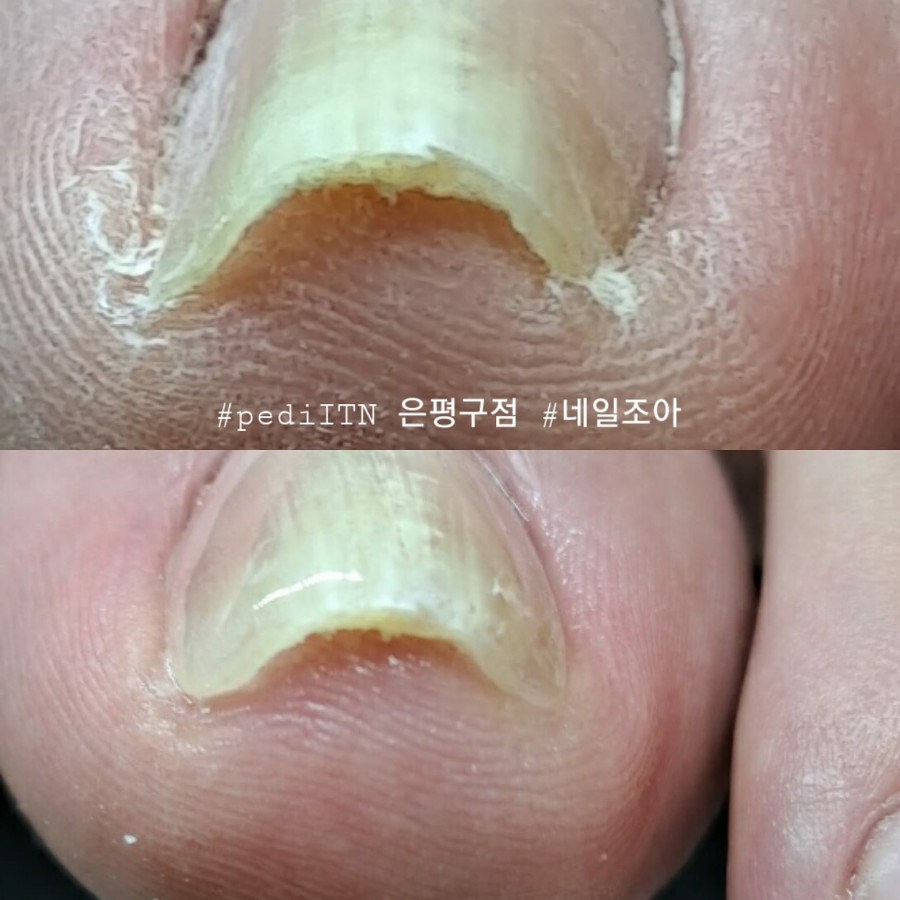 네일조아 이미지