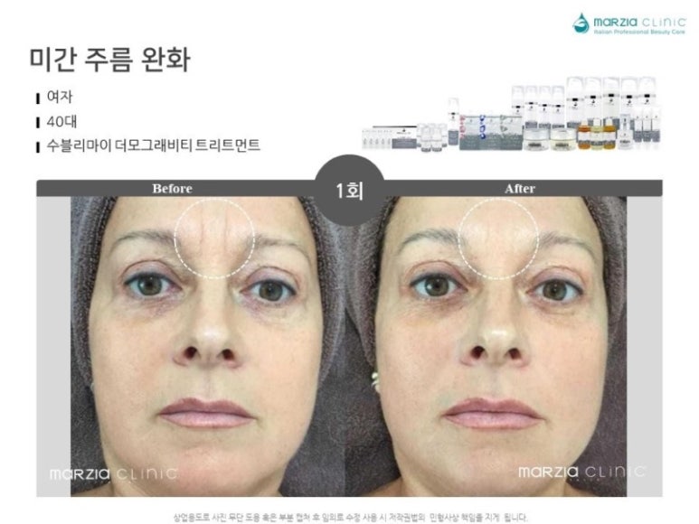 수블리 이미지