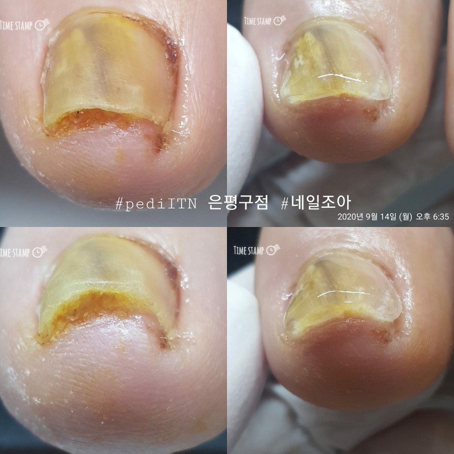 네일조아 이미지