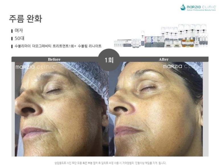 수블리 이미지