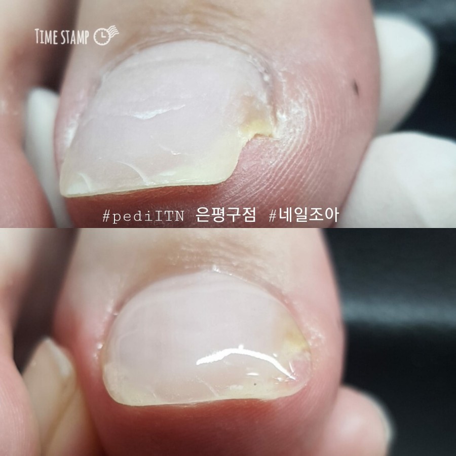 네일조아 이미지