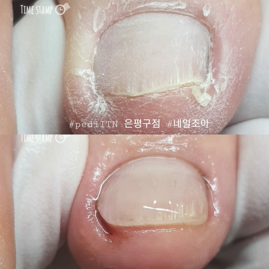 네일조아 이미지