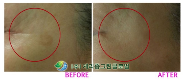 리즈테라피 이미지
