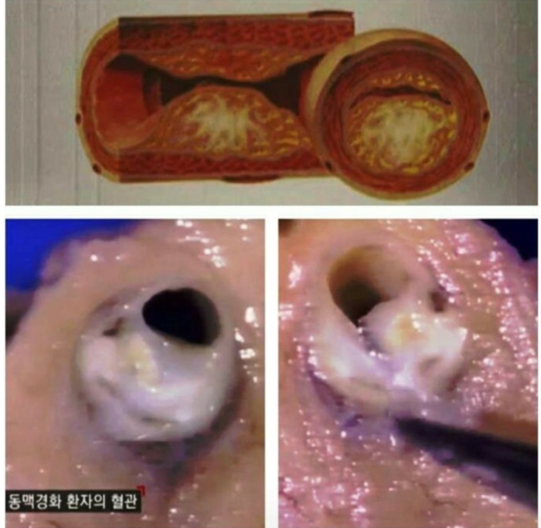 옐로우점핑 이미지