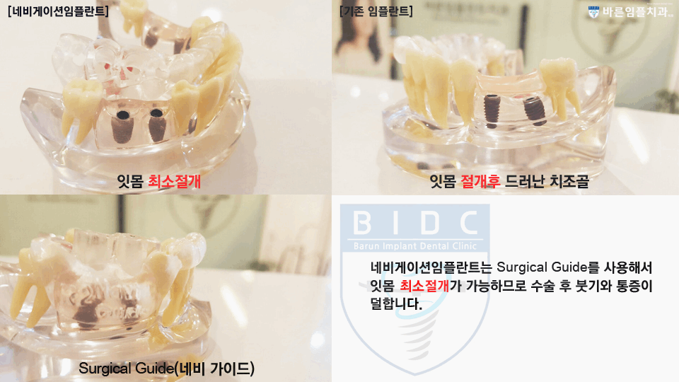 바른사람치과 이미지