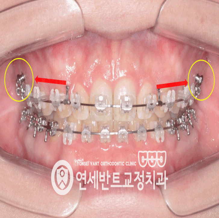 연세길치과의원 이미지
