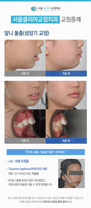 서울클리어치과교정과치과의원 이미지