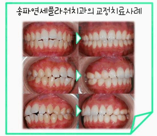 연세바른치과의원 이미지