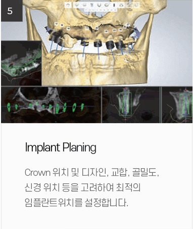 더웃는치과 이미지