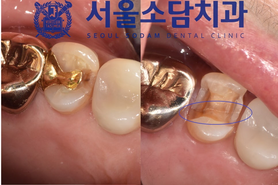 서울소담치과 이미지