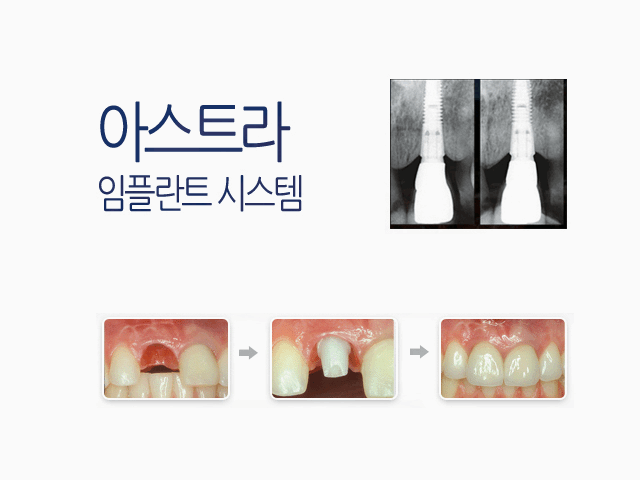 더블유치과 이미지