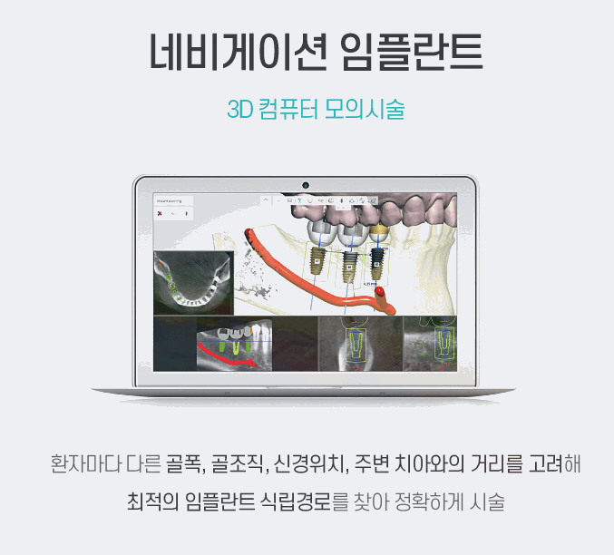 가지런한치과교정과치과의원 이미지