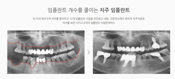 연세미소치과의원 이미지