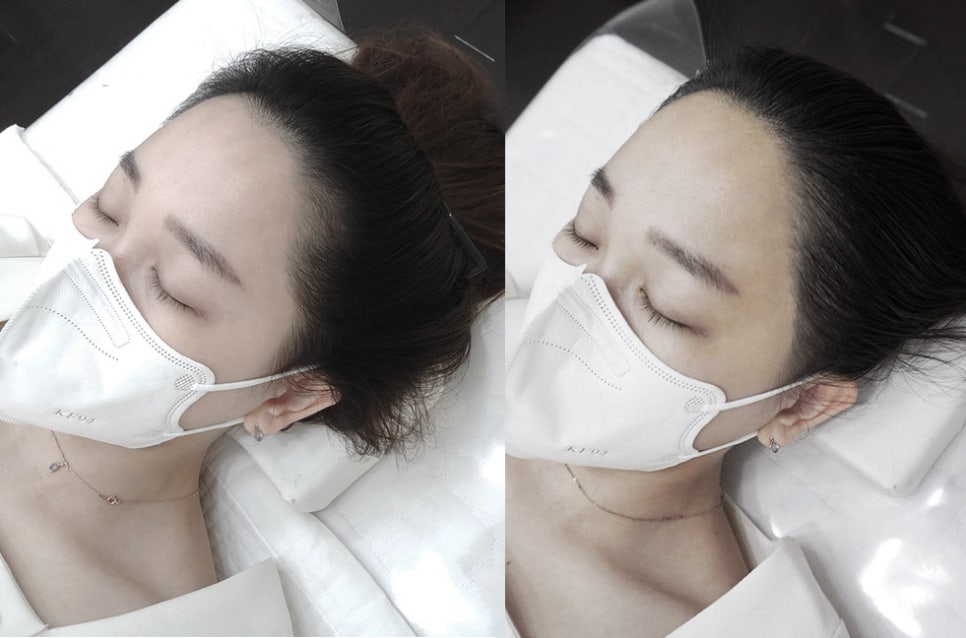 비비헤어(BB헤어) 이미지