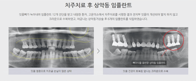 연세본치과의원 이미지
