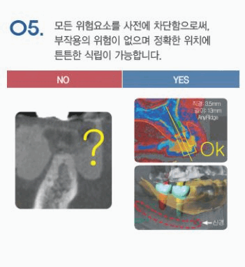 바른본치과 이미지