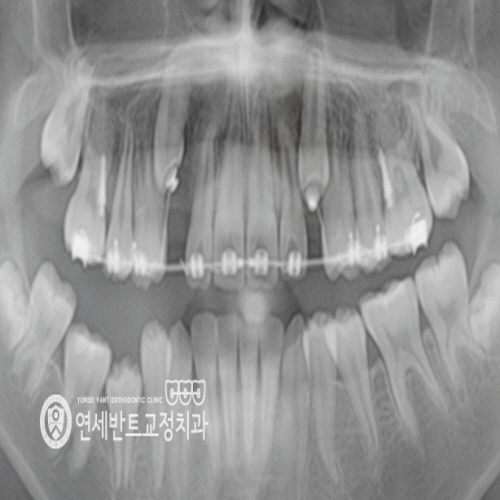 반트치과교정과치과의원 이미지