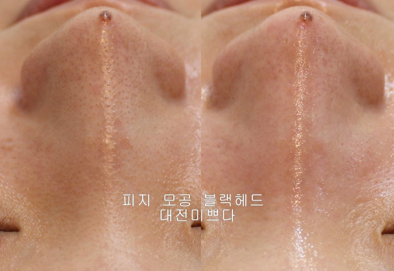 미쁘다피부관리 이미지