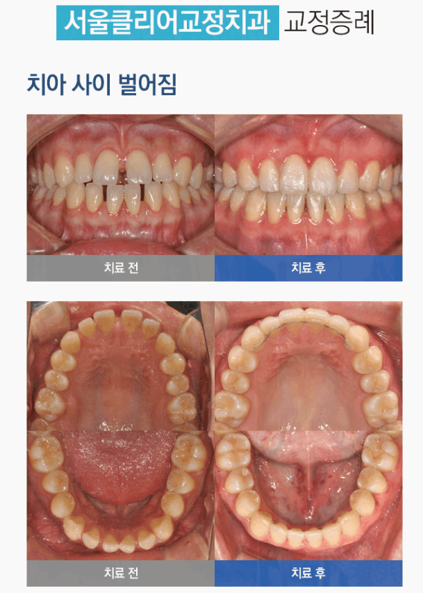 서울클리어치과교정과치과의원 이미지