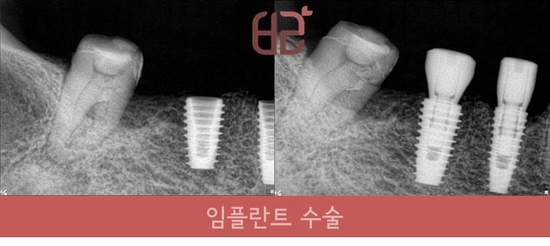 연세바른치과 이미지
