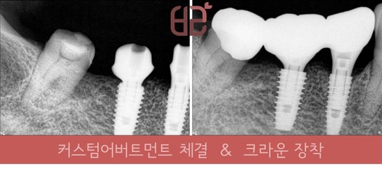 연세바른치과 이미지
