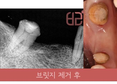 연세바른치과 이미지