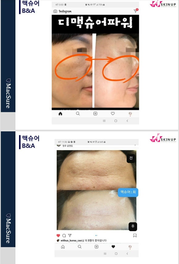 해피바디앤스킨 이미지