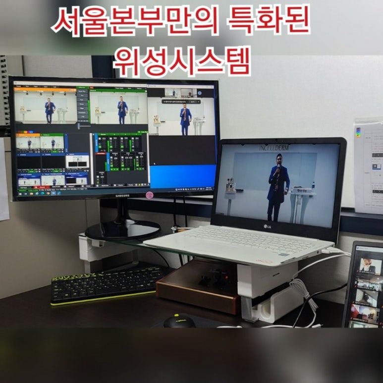 세계로 인셀덤 이미지
