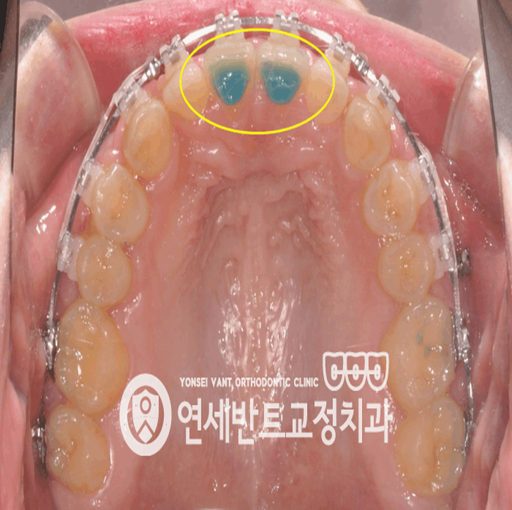 반트치과교정과치과의원 이미지
