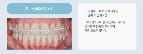 연세고운미소치과의원 이미지