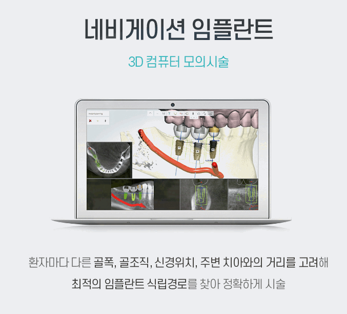 강남사랑니치과의원 이미지