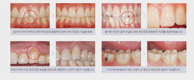 연세믿음치과 이미지