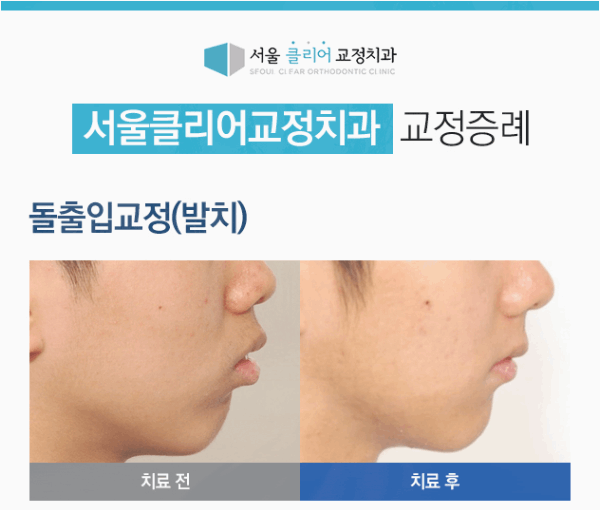서울클리어치과교정과치과의원 이미지