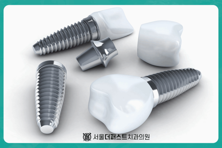 서울이좋은치과 이미지