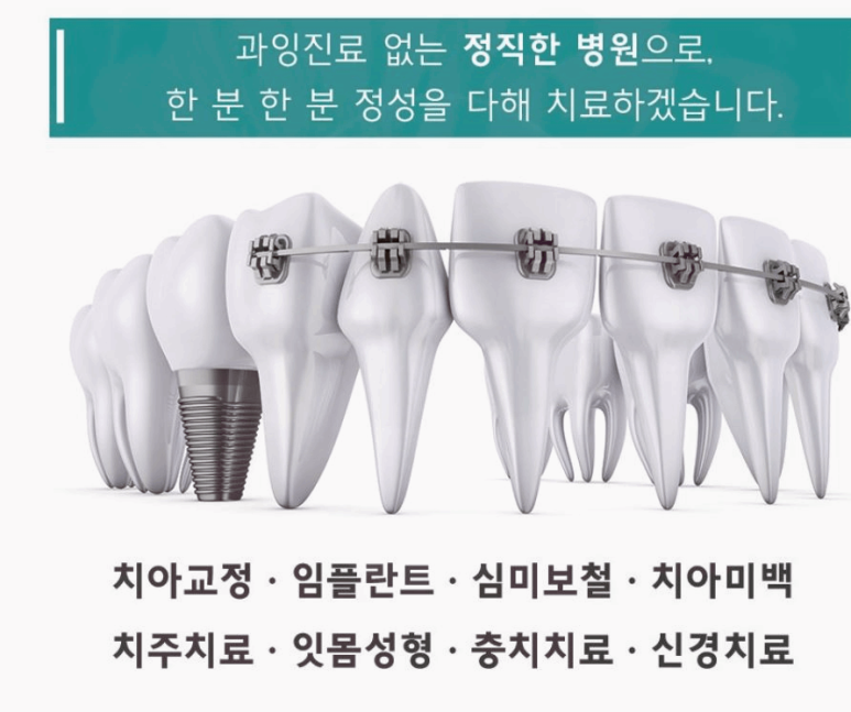 서울더블유치과 이미지