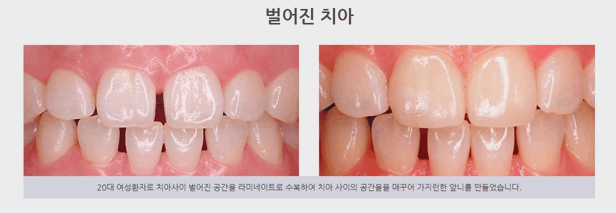 좋은미소치과의원 이미지