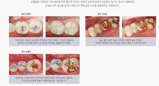 연세고운미소치과의원 이미지